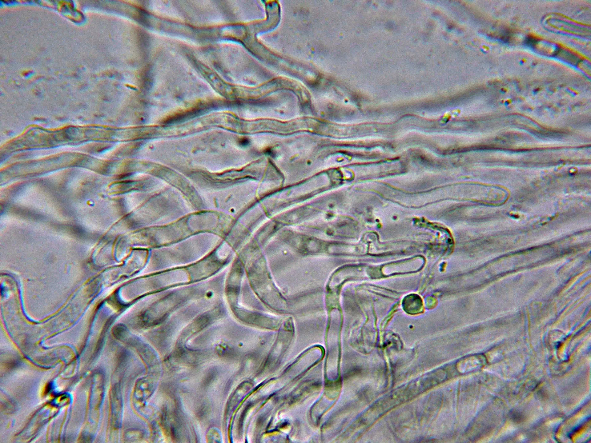 6 - Suprapellis agua-001